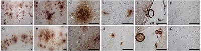 Nitrosative Stress in the Frontal Cortex From Dogs With Canine Cognitive Dysfunction